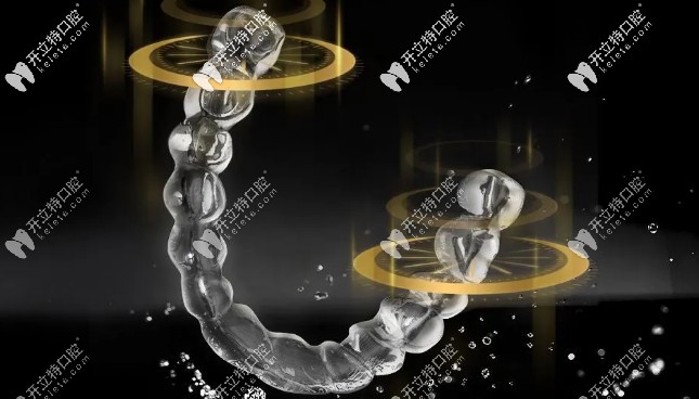 想知道國產(chǎn)隱形牙套—正雅悅享版價格的，請舉手！