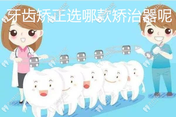 牙齒矯正該選擇哪款矯治器呢