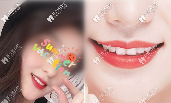 七夕格倫菲爾口腔活動(dòng)