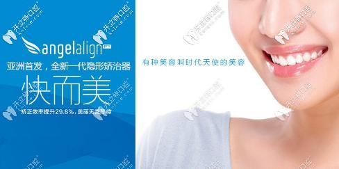 天津美奧口腔做時代天使無托槽牙套費用來襲,收費不高喲