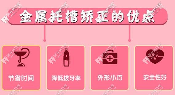 固定鋼絲牙套的優(yōu)點(diǎn)