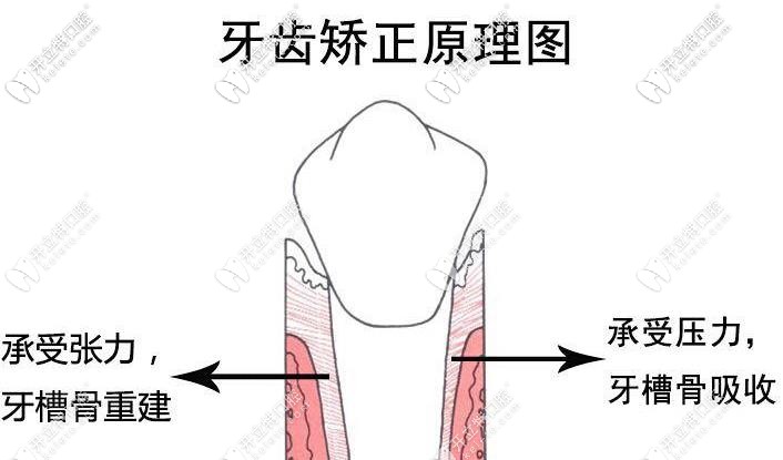 牙齒移動(dòng)的過(guò)程