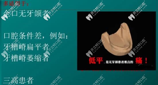 bps吸附性義齒的適應(yīng)癥