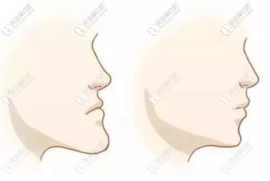 長沙地包天矯正做的好的醫(yī)院名單，兒童成人都有