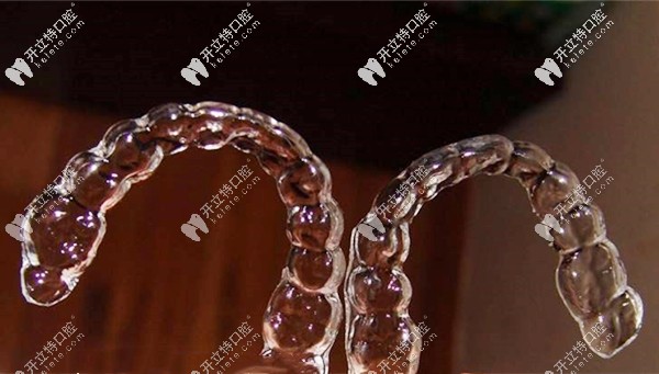 山西太原隱形矯正價(jià)格介紹