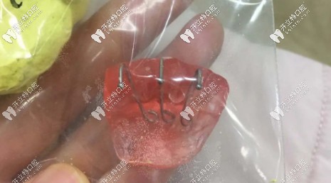 時(shí)隔8個(gè)月，用上了平導(dǎo)和骨釘