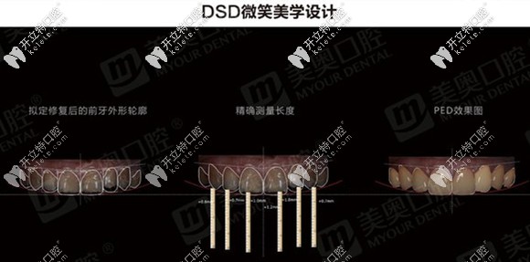 DSD微笑美學(xué)設(shè)計