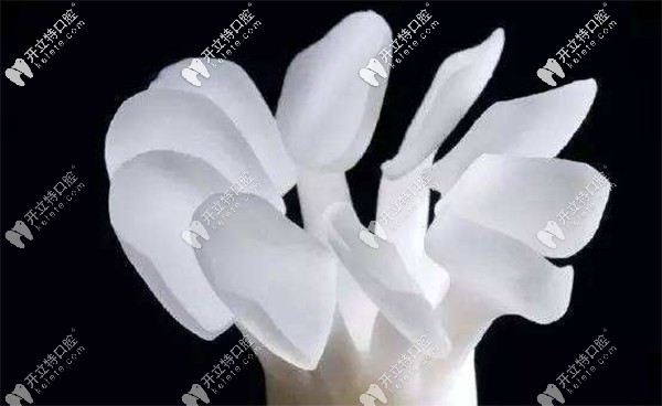 瑞士進(jìn)口Emax全瓷牙貼面實(shí)例