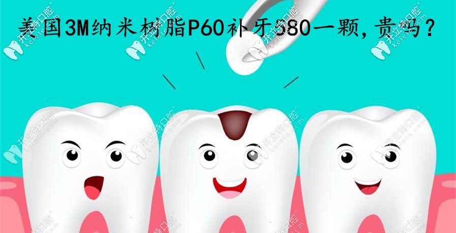 在煙臺(tái)做美國3MP60納米樹脂補(bǔ)牙580一顆，這費(fèi)用算貴嗎
