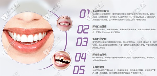 判斷自己做哪種方式牙齒矯正