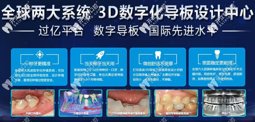 東莞好佰年寮步種植牙設(shè)計(jì)中心
