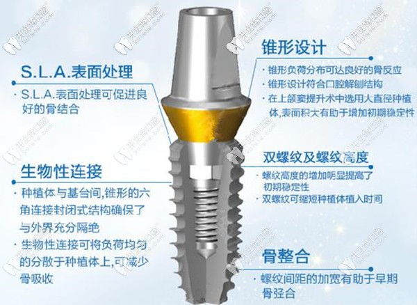 登騰種植體的優(yōu)勢(shì)