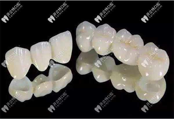 沈陽百嘉麗全瓷冠