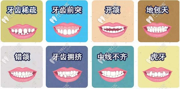 金屬托槽矯正適應(yīng)癥