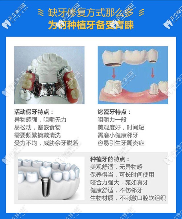 種植牙和假牙的區(qū)別