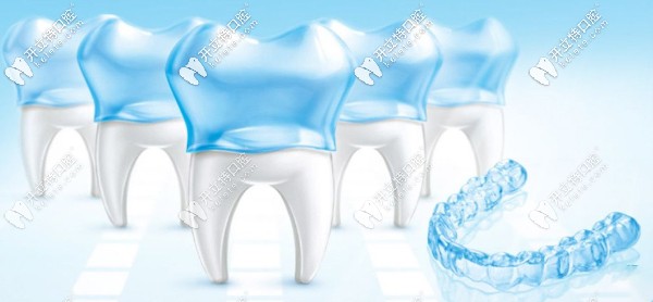 時(shí)代天使comfos青春版牙套多久換一次