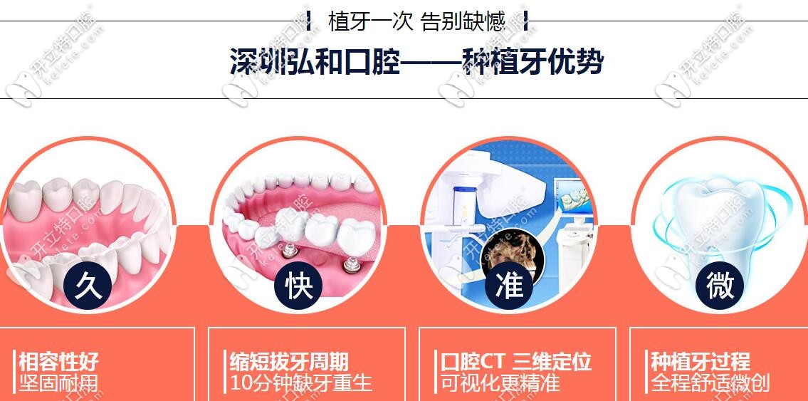 深圳弘和口腔種植牙優(yōu)勢