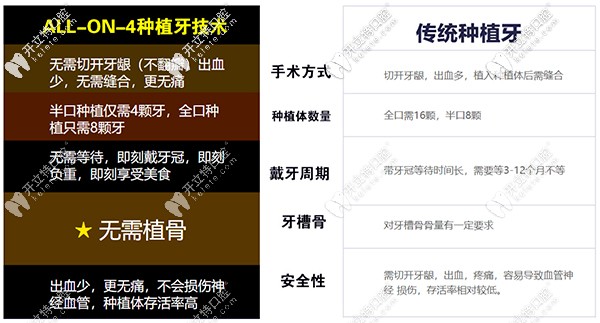 All-on-4速導(dǎo)種植牙相比較于傳統(tǒng)種植牙優(yōu)勢(shì)