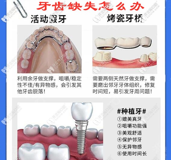 牙齒缺失怎么辦 牙齒缺失怎么辦