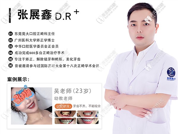 東莞莞大口腔正畸科主任張展鑫