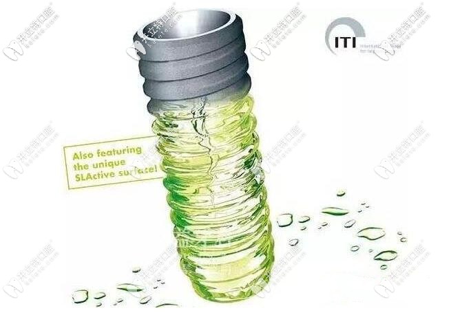 瑞士ITI種植牙系統(tǒng)優(yōu)勢