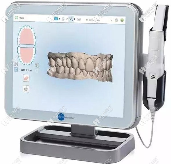 ITERO二代口掃設(shè)備的特色