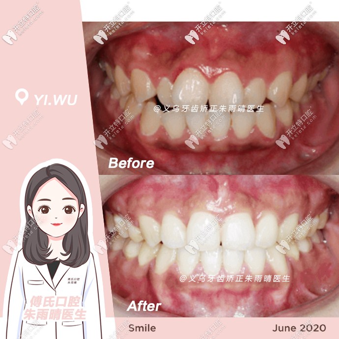 矯正前后對(duì)比圖