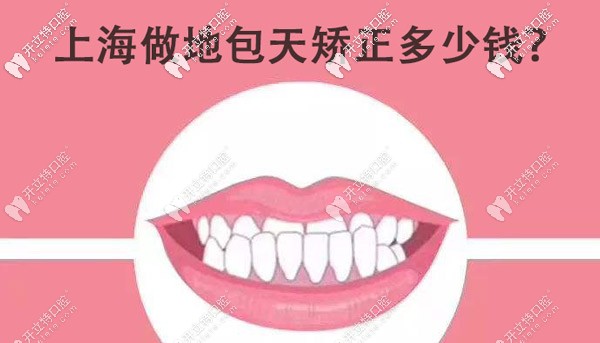 想知道在上海正規(guī)牙科做地包天矯正的費(fèi)用大概是多少嗎？