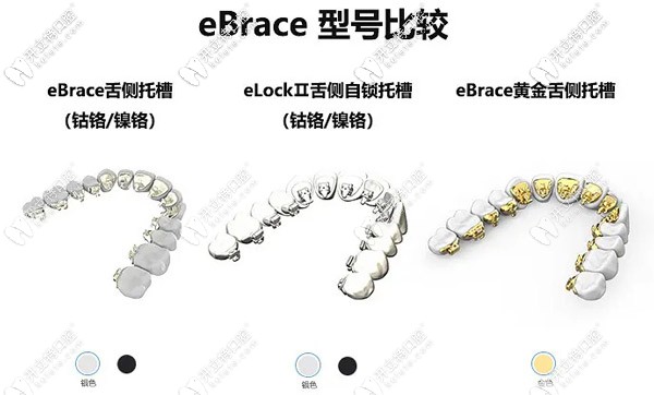 國產Ebrace舌側矯正起器型號對比