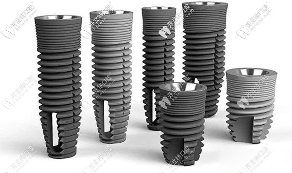 種植體品牌影響種植牙價(jià)格