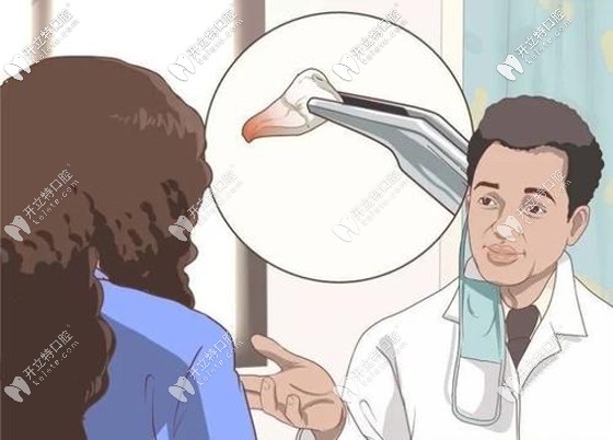 不同的口腔情況種牙價格也不同