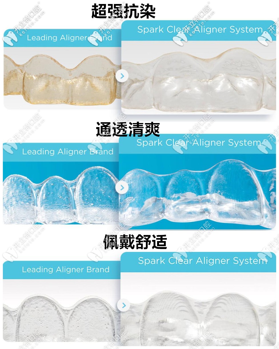 美國spark公司的ormco隱形矯正特點 美國spark公司的ormco隱形矯正特點