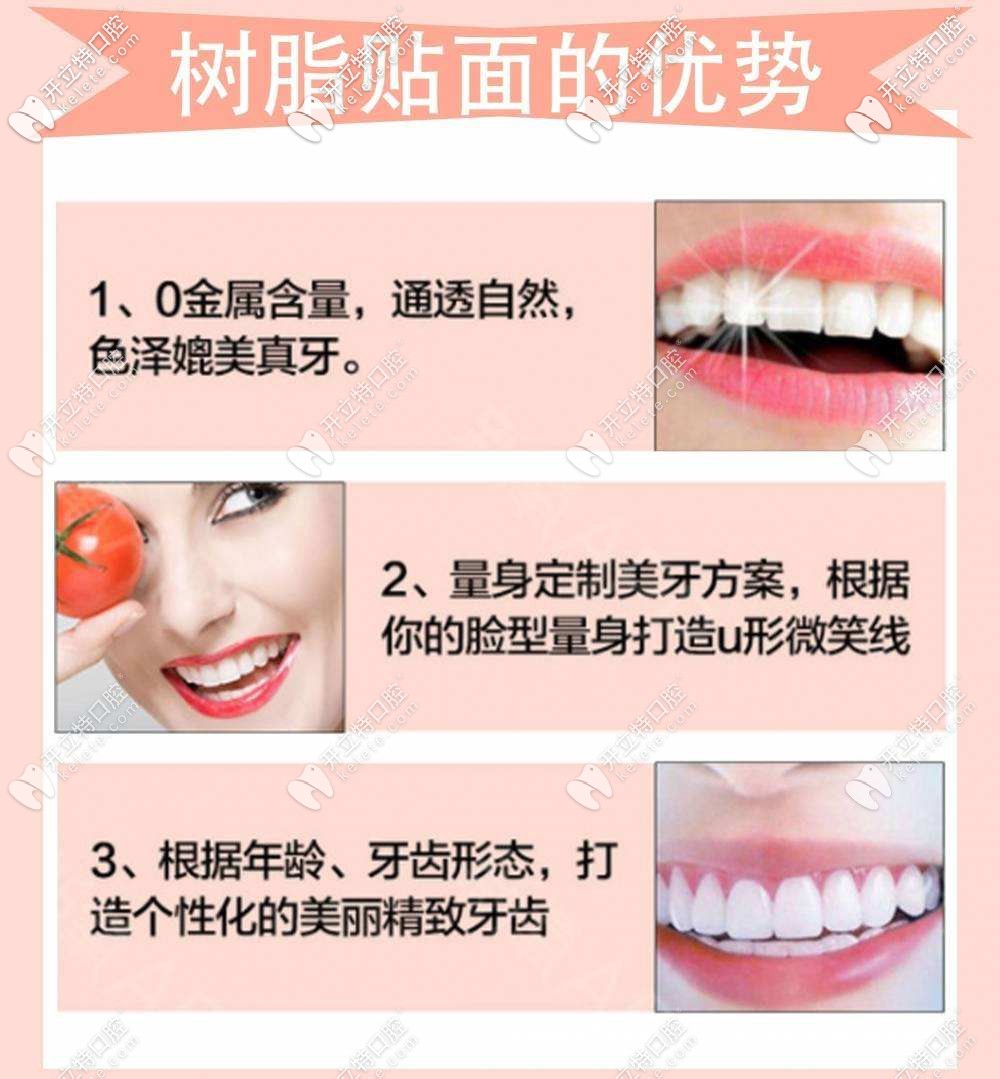 樹脂貼面的優(yōu)勢