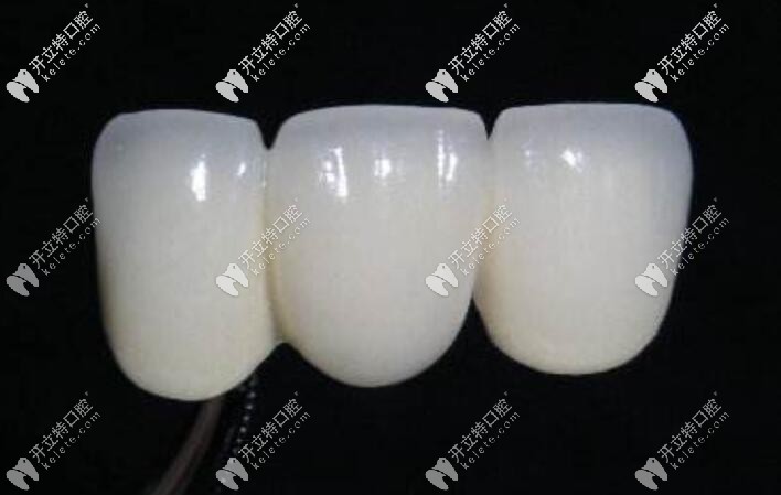 全瓷牙價(jià)格高但是美觀度好