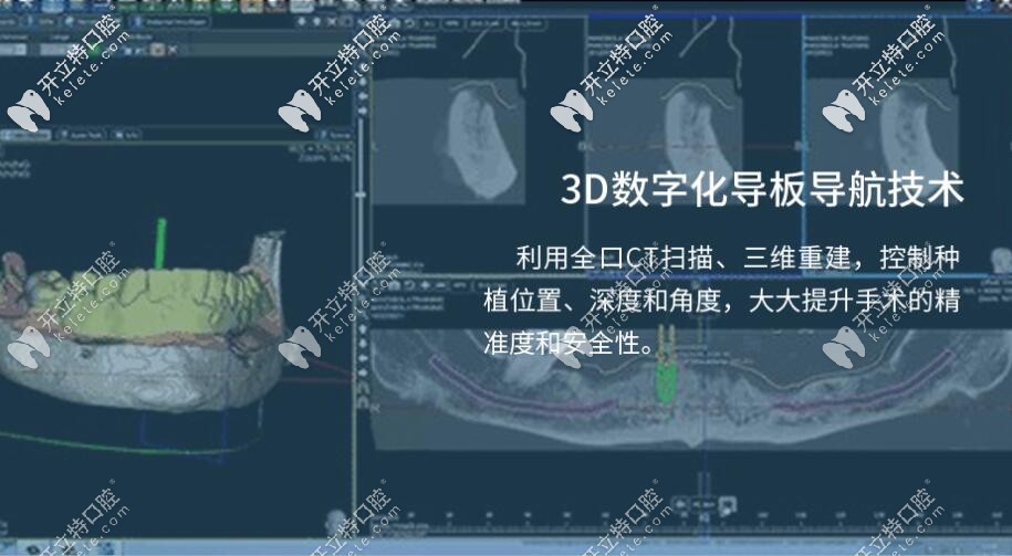 3D數(shù)字化導(dǎo)航技術(shù)特點(diǎn) 3D數(shù)字化導(dǎo)航技術(shù)特點(diǎn)