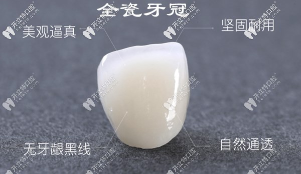 深圳柏齒康口腔全瓷牙冠