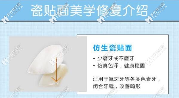 深圳柏齒康口腔牙齒瓷貼面