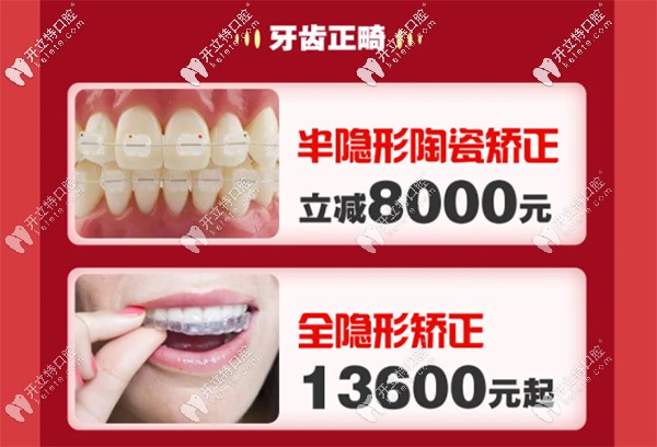 深圳銘德口腔做國產(chǎn)全隱形矯正價格13600元起