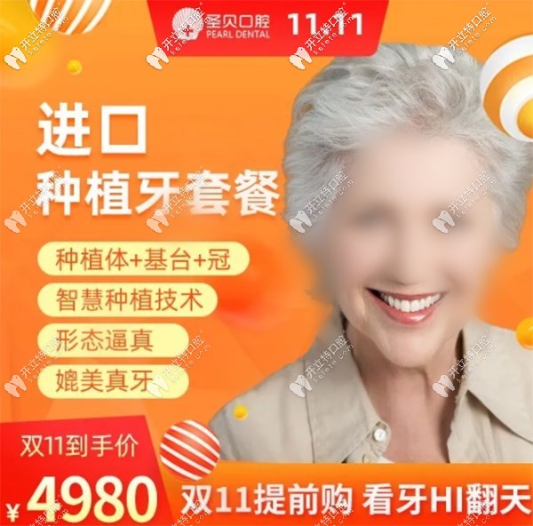 北京朝陽圣貝做韓系進(jìn)口種植牙價(jià)位4980元起，雙11buy