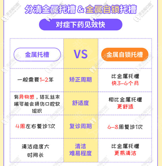 金屬牙套與金屬自鎖牙套的區(qū)別