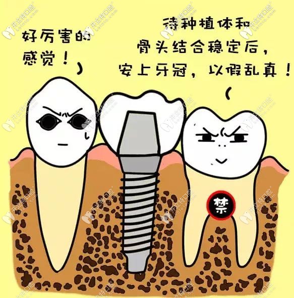 石家莊中諾口腔種植牙價格表(2974-6794元起)二級醫(yī)院|技術(shù)好