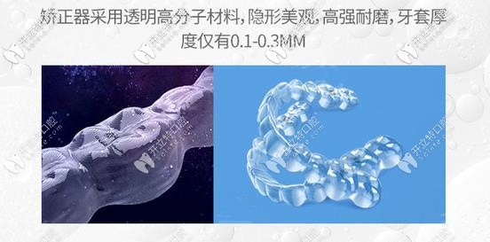 comfos隱形牙套優(yōu)勢(shì)