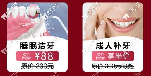 成人補(bǔ)牙、潔牙活動(dòng)