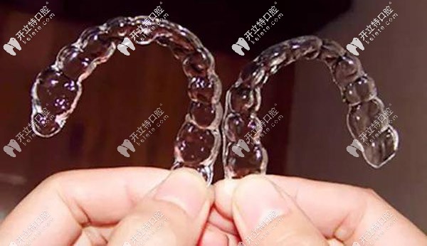 隱形矯正深覆合效果不錯(cuò)