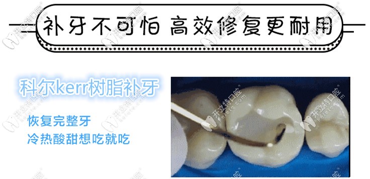 科爾樹脂補(bǔ)牙
