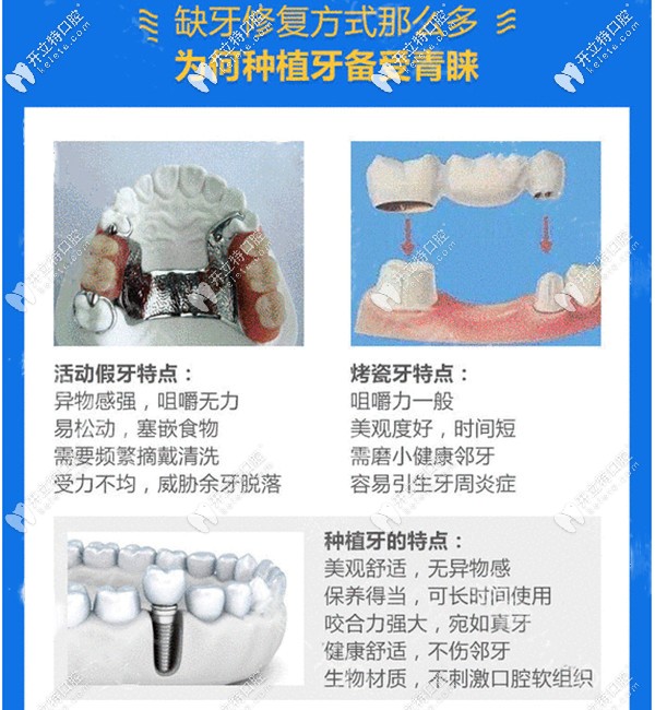 韓國奧齒泰種植牙的優(yōu)勢