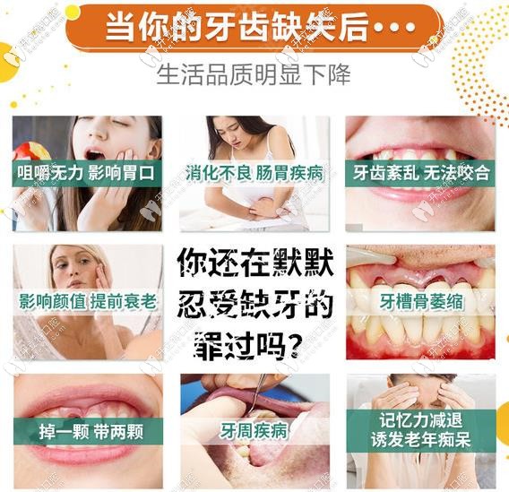 缺牙危害不能拖要及時(shí)醫(yī)治