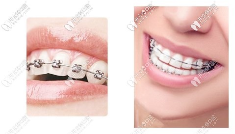 深扒了德陽口腔醫(yī)院價格表，這樣的收費標準你中意么