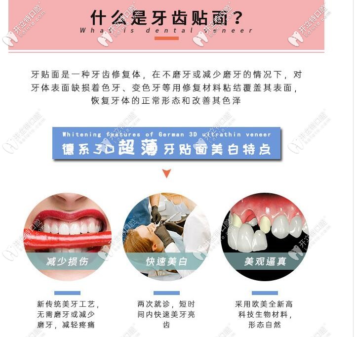 牙齒貼面及其特點介紹