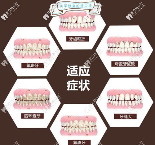 尤樂平醫(yī)生的擅長(zhǎng)項(xiàng)目介紹